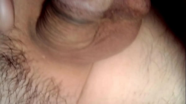 endoscopio per fibra uretrale